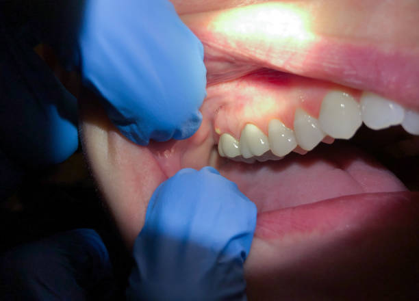 Best Broken Tooth Emergency  in Pikeville, TN