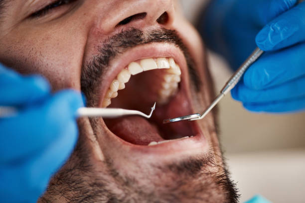 Best Chipped Tooth Repair Near Me  in Pikeville, TN